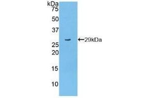 Detection of Recombinant PARP, Mouse using Polyclonal Antibody to Poly ADP Ribose Polymerase (PARP) (PARP1 antibody  (AA 661-881))