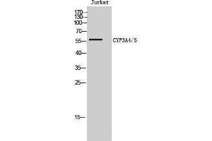 Western Blotting (WB) image for anti-Cytochrome P450, Family 3, Subfamily A, Polypeptide 4/5 (CYP3A4) (Internal Region) antibody (ABIN6282328) (CYP3A4 antibody  (Internal Region))