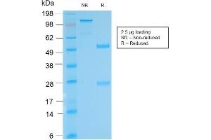 SDS-PAGE Analysis Purified anti-biotin Rabbit Recombinant Monoclonal antibody (BTN/2032R). (Recombinant Biotin antibody)
