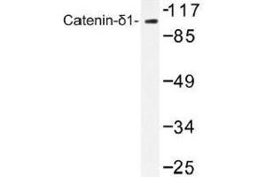 Image no. 1 for anti-Catenin (Cadherin-Associated Protein), delta 1 (CTNND1) antibody (ABIN317789) (CTNND1 antibody)