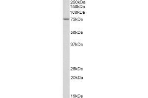 ABIN4902777 (2µg/ml) staining of Jurkat nuclear lysate (35µg protein in RIPA buffer). (TDP1 antibody)