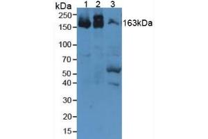 Western Blotting (WB) image for alpha-2-Macroglobulin (A2M) ELISA Kit (ABIN6574099)