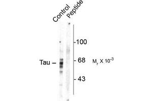 Image no. 1 for anti-Microtubule-Associated Protein tau (MAPT) (pSer416) antibody (ABIN303964) (MAPT antibody  (pSer416))