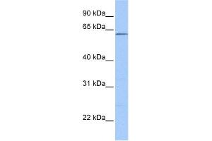 WB Suggested Anti-ZKSCAN4 Antibody Titration:  0. (ZKSCAN4 antibody  (N-Term))