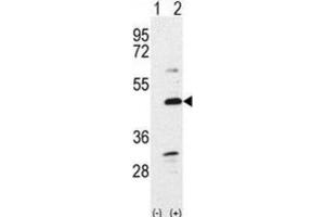 Western Blotting (WB) image for anti-Bone Morphogenetic Protein 7 (BMP7) antibody (ABIN2999272) (BMP7 antibody)