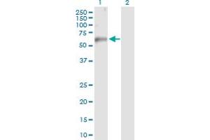 Western Blot analysis of TRAF6 expression in transfected 293T cell line by TRAF6 MaxPab polyclonal antibody. (TRAF6 antibody  (AA 1-522))