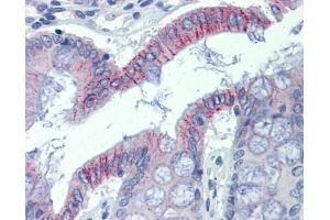 Desmoglein 2 antibody was used for immunohistochemistry at a concentration of 4-8 ug/ml. (Desmoglein 2 antibody  (N-Term))