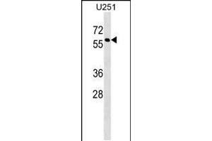 Western blot analysis in U251 cell line lysates (35ug/lane). (MPI antibody  (N-Term))