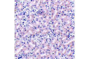 Immunohistochemistry (IHC) image for anti-Hepatitis A Virus Cellular Receptor 1 (HAVCR1) (N-Term) antibody (ABIN1031616) (HAVCR1 antibody  (N-Term))