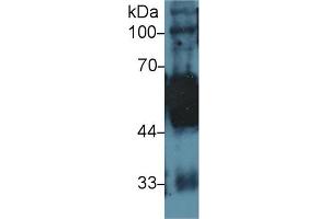 Western Blot; Sample: Rat Tongue lysate; Primary Ab: 1µg/ml Rabbit Anti-Human KRT5 Antibody Second Ab: 0. (Cytokeratin 5 antibody  (AA 166-474))