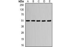 Western blot analysis of Alpha-tubulin 4a expression in HepG2 (A), MCF7 (B), mouse heart (C), mouse brain (D), PC12 (E) whole cell lysates. (TUBA4A antibody)