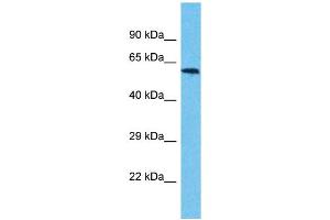 Western Blotting (WB) image for anti-Ubiquitin Specific Peptidase 17-Like Family Member 3 (USP17L3) (C-Term) antibody (ABIN2791977) (USP17L3 antibody  (C-Term))