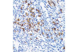 Immunohistochemistry of paraffin-embedded human tonsil using TNFSF12 Antibody (ABIN1876860) at dilution of 1:100 (40x lens). (TWEAK antibody)