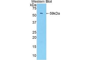 Western blot analysis of the recombinant protein. (IRF1 antibody  (AA 44-319))