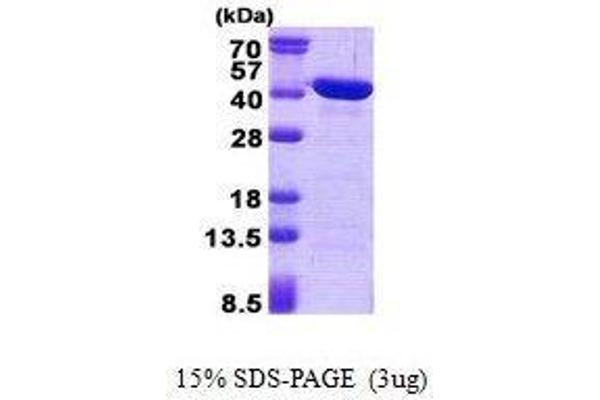 CAB39L Protein