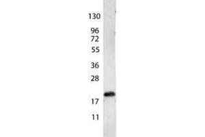 Image no. 1 for anti-Vascular Endothelial Growth Factor A (VEGFA) antibody (ABIN1104981) (VEGFA antibody)