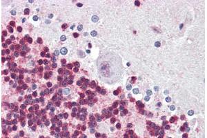 Human Brain, Cerebellum (formalin-fixed, paraffin-embedded) stained with ANP32A antibody ABIN461886 at 5 ug/ml followed by biotinylated goat anti-rabbit IgG secondary antibody ABIN481713, alkaline phosphatase-streptavidin and chromogen. (PHAP1 antibody  (C-Term))