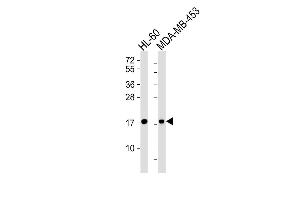 Lane 1: HL-60 Cell lysates, Lane 2: MDA-MB-453 Cell lysates, probed with FHIT (1093CT23. (FHIT antibody)