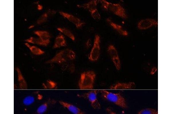 MCTS1 antibody