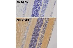 Immunohistochemistry (IHC) image for anti-STIP1 Homology and U-Box Containing Protein 1 (STUB1) antibody (ABIN6254206) (STUB1 antibody)