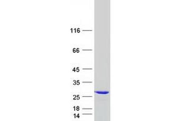 RAB11B Protein (Myc-DYKDDDDK Tag)