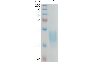 Human DL3 Protein, His Tag on SDS-PAGE under reducing condition. (KIR2DL3 Protein (AA 22-245) (His tag))