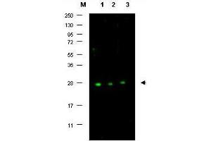 Image no. 1 for anti-P27 antibody (ABIN636752) (P27 antibody)