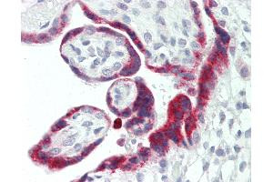 Human Placenta: Formalin-Fixed, Paraffin-Embedded (FFPE). (CD200 antibody  (AA 175-224))
