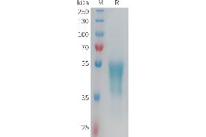 Human Protein, hFc Tag on SDS-PAGE under reducing condition. (G Protein-Coupled Receptor 132 Protein (GPR132) (AA 1-45) (Fc Tag))