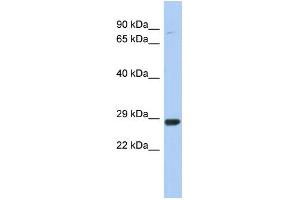 WB Suggested Anti-C21orf91 Antibody Titration:  0. (C21orf91 antibody  (Middle Region))