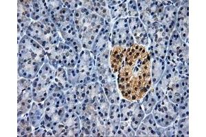 Immunohistochemistry (IHC) image for anti-ELAV (Embryonic Lethal, Abnormal Vision, Drosophila)-Like 1 (Hu Antigen R) (ELAVL1) antibody (ABIN1498002) (ELAVL1 antibody)