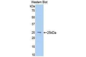 Western Blotting (WB) image for N-Acetylgalactosaminidase, alpha (NAGA) ELISA Kit (ABIN6720594)