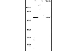 L1 rat lung lysates L2 human colon carcinoma lysates probed with Anti hnRNP L Polyclonal Antibody, Unconjugated (ABIN706631) at 1:200 in 4 °C. (HNRNPL antibody  (AA 501-589))