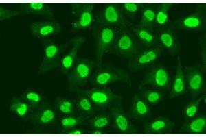 Immunofluorescence analysis of A549 cells using RFC1 Polyclonal Antibody (RFC1 antibody)