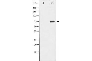 Western blot analysis of PKR phosphorylation expression in Starvation treated K562 whole cell lysates,The lane on the left is treated with the antigen-specific peptide. (EIF2AK2 antibody  (pThr446))