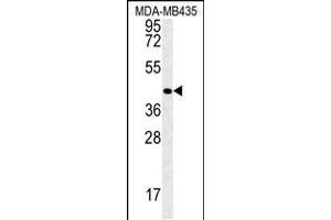 Western blot analysis in MDA-MB435 cell line lysates (35ug/lane). (Vasohibin 2 antibody  (C-Term))