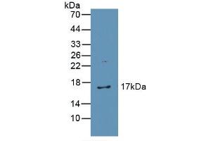 Western blot analysis of recombinant Human CAT. (Catalase antibody  (AA 32-167))