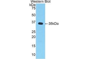 Western blot analysis of the recombinant protein. (CXCL1 antibody  (AA 25-96))