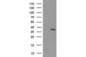 Image no. 2 for anti-Uracil-DNA Glycosylase (UNG) antibody (ABIN1501679) (UNG antibody)