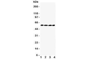 Western blot testing of IRF5 antibody and Lane 1:  human placenta;  2: rat thymus;  3: (r) kidney;  4: (r) ovary tissue lysate. (IRF5 antibody  (C-Term))