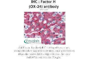 Image no. 1 for anti-Complement Factor H (CFH) antibody (ABIN1723178) (Complement Factor H antibody)