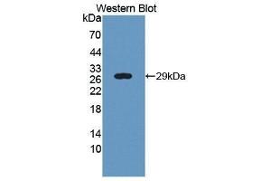 Western Blotting (WB) image for anti-Ubiquitin (Ubiquitin) (AA 1-76) antibody (ABIN1172489) (Ubiquitin antibody  (AA 1-76))