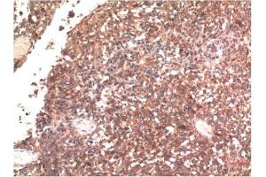 Immunohistochemical analysis of paraffin-embedded Human Brain Tissue using Tau Mouse mAb diluted at 1:200. (tau antibody)