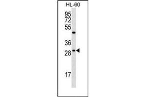 Western blot analysis of FMR1NB Antibody (N-term) in HL-60 cell line lysates (35ug/lane). (FMR1NB antibody  (N-Term))