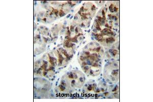 CTGF Antibody (Center) (ABIN657322 and ABIN2846396) immunohistochemistry analysis in formalin fixed and paraffin embedded human stomach tissue followed by peroxidase conjugation of the secondary antibody and DAB staining. (CTGF antibody  (AA 166-193))