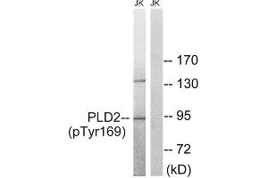 Western Blotting (WB) image for anti-Phospholipase D2 (PLD2) (pTyr169) antibody (ABIN1847811) (Phospholipase D2 antibody  (pTyr169))