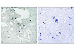Immunohistochemistry (IHC) image for anti-B-Cell Linker (BLNK) (pTyr84) antibody (ABIN1847671) (B-Cell Linker antibody  (pTyr84))