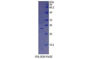 SDS-PAGE (SDS) image for Insulin-Like Growth Factor Binding Protein 6 (IGFBP6) (AA 31-240) protein (His tag) (ABIN2121301) (IGFBP6 Protein (AA 31-240) (His tag))