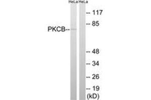 Western Blotting (WB) image for anti-Protein Kinase C, beta (PRKCB) (AA 622-671) antibody (ABIN2889116) (PKC beta antibody  (AA 622-671))