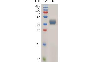 Human Protein, hFc Tag on SDS-PAGE under reducing condition. (CCR1 Protein (AA 1-34) (Fc Tag))